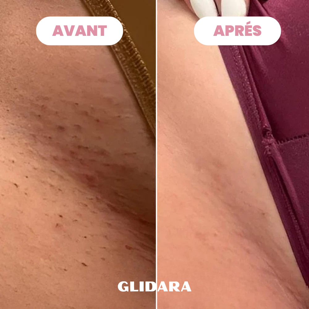 Rasoir Glidara™