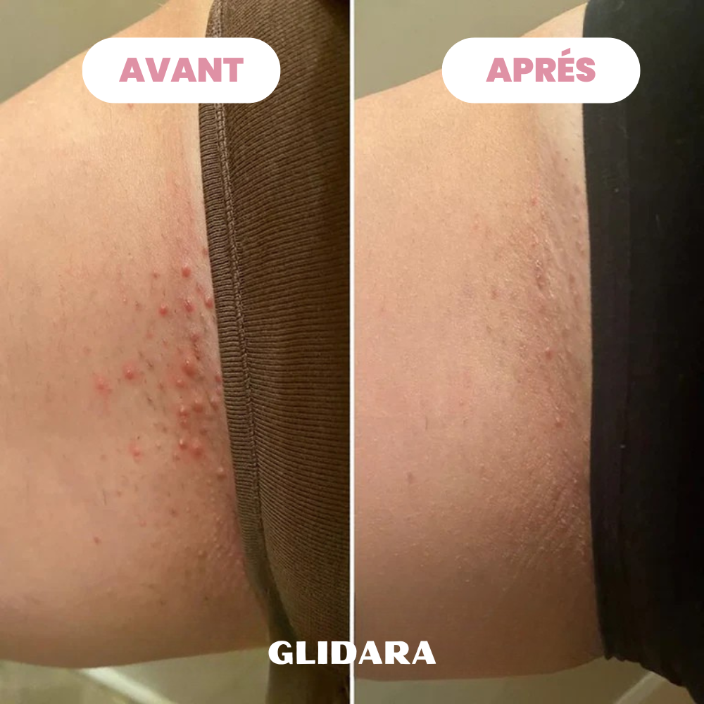 Rasoir Glidara™