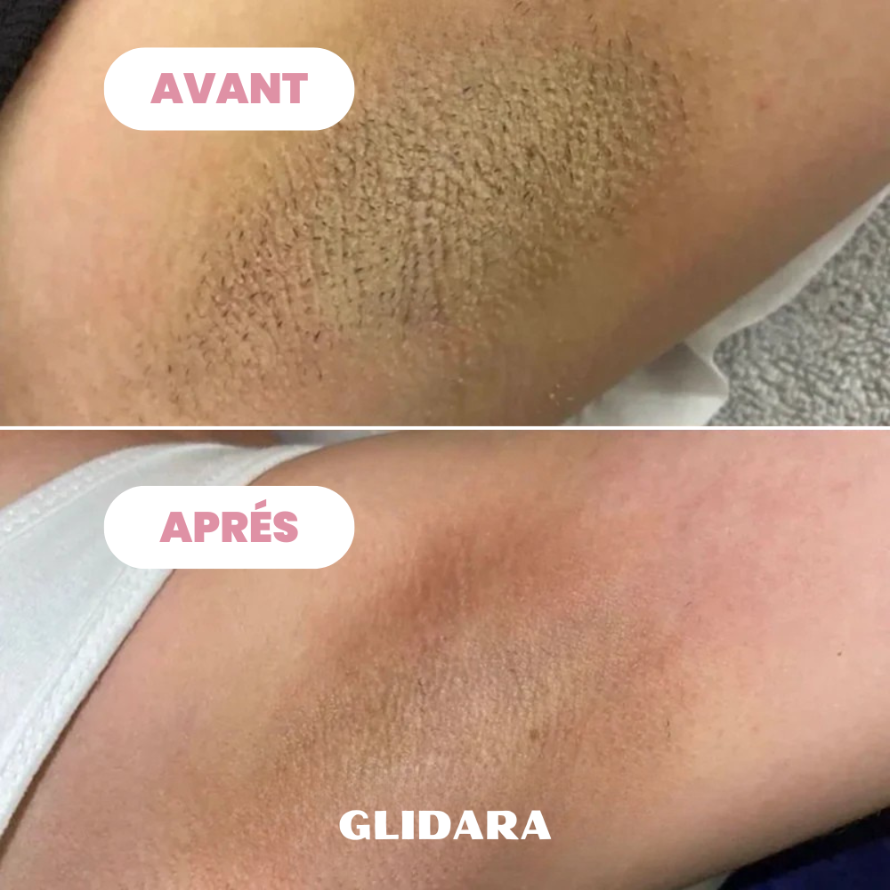 Rasoir Glidara™