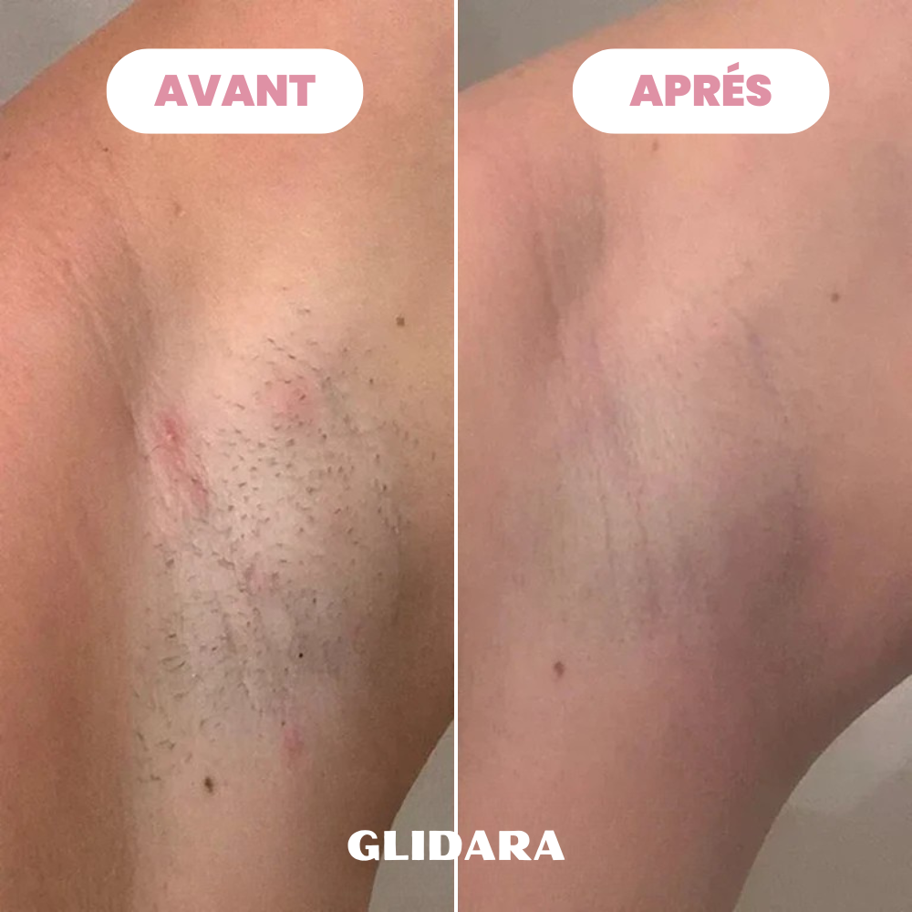 Rasoir Glidara™