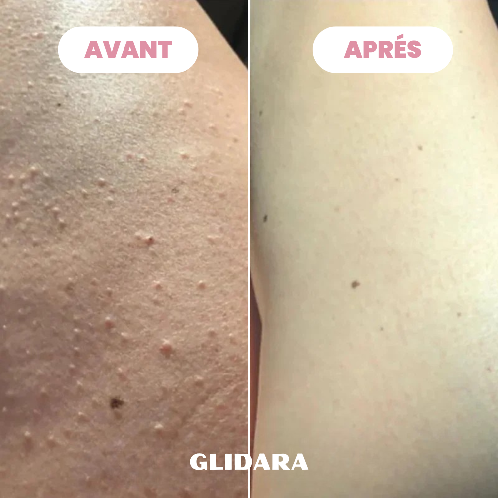 Rasoir Glidara™